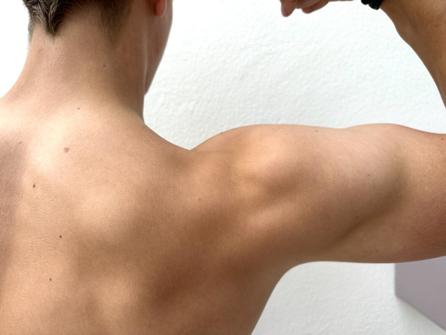 Rotatorenmanschette - Bild von einem nackten Männerrücken mit angespanntem Arm und Schulter, MRT Untersuchung in der Radiologie Mühleninsel