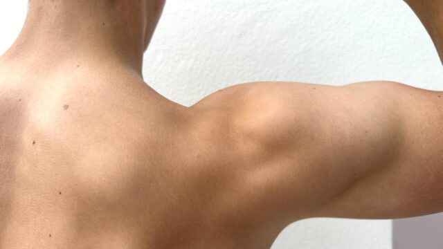 Rotatorenmanschette - Bild von einem nackten Männerrücken mit angespanntem Arm und Schulter, MRT Untersuchung in der Radiologie Mühleninsel