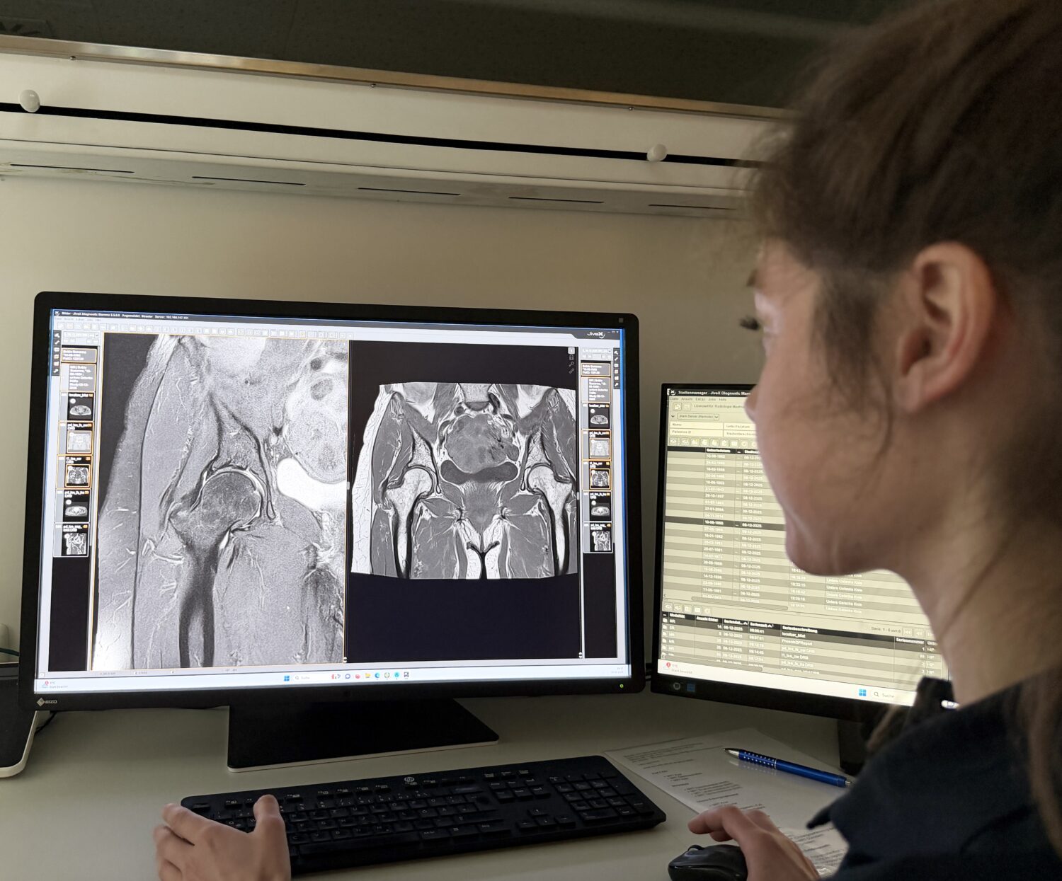 MRT Hüfte in der Radiologie Mühleninsel. Befundbesprechung vor einem Computer mit Ärztin und Patientin.