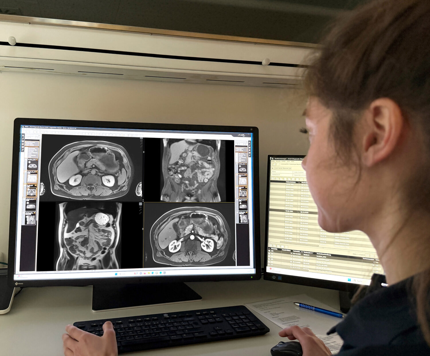 Eine Medizinerin von hinten betrachtet konzentriert einen großen Diagnostikmonitor, auf dem vier MRT-Aufnahmen des Abdomens in verschiedenen Schnittebenen (axial und koronal) nebeneinander dargestellt sind. Auf einem zweiten Monitor rechts ist ein Studienmanagementsystem geöffnet. Vor ihr liegt ein Notizblock mit Stift."