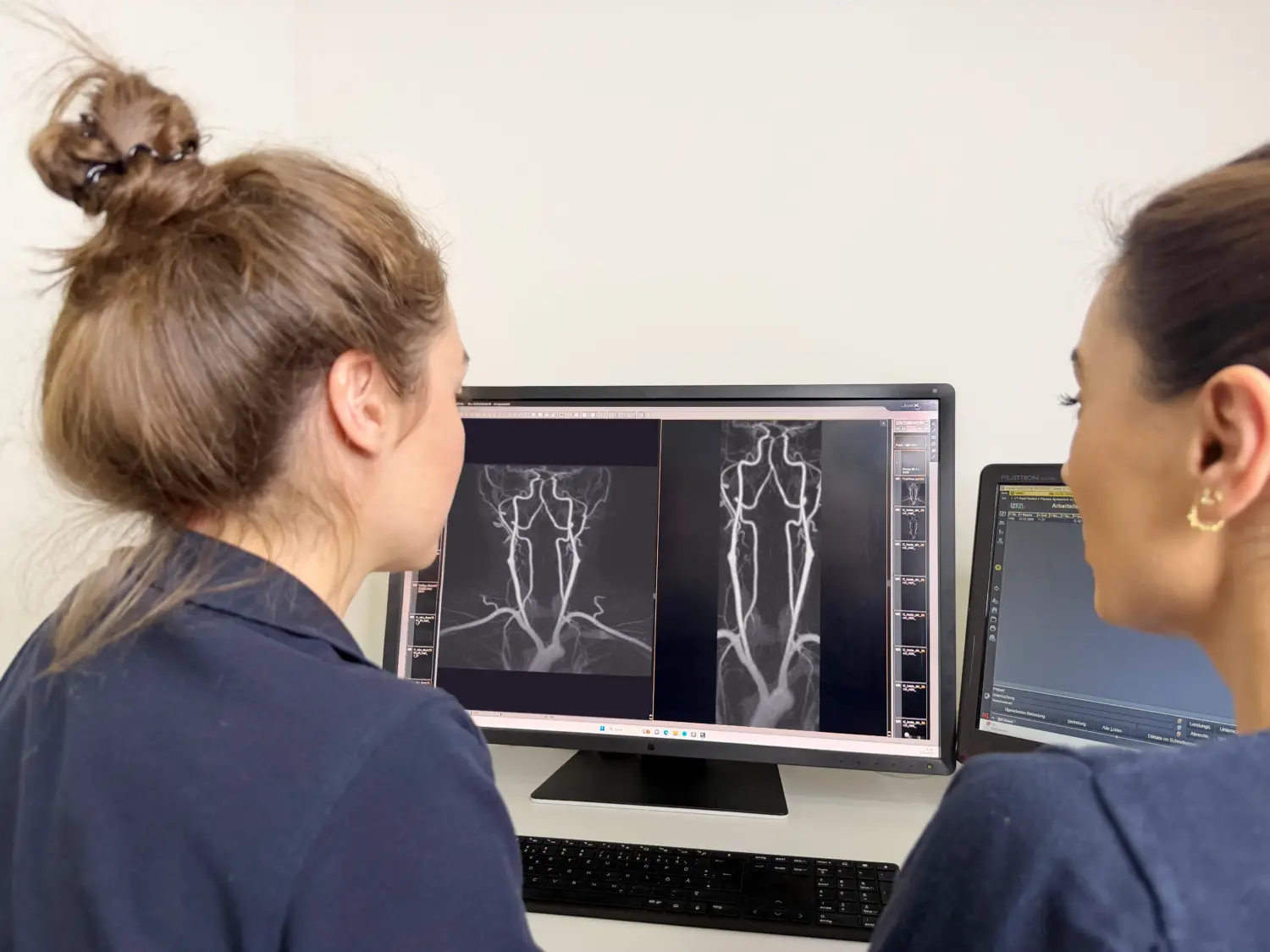 MR-Angiographie Kopf & Hals